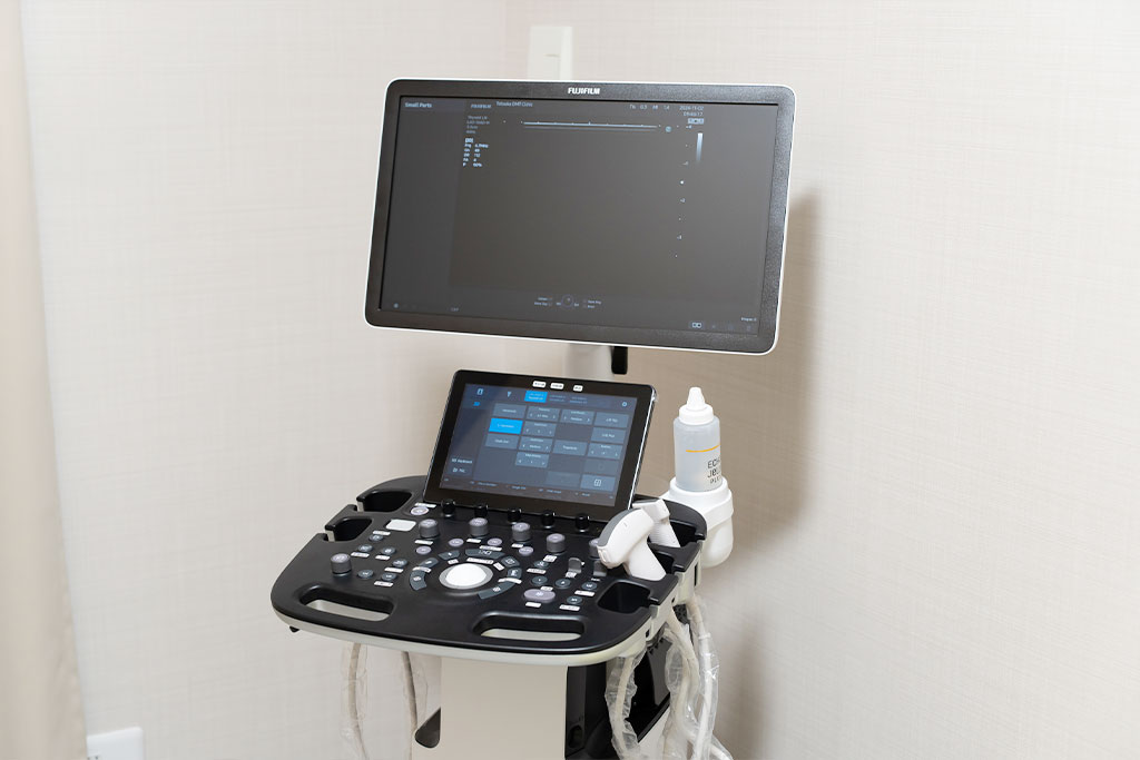 超音波診断装置